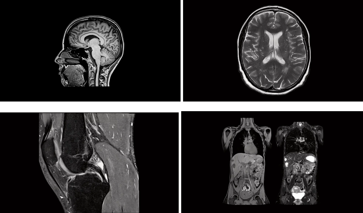 87-observation-elements-examples-of-tomograms-of-people-made-by-magnetic-resonance-imaging-scanners Примеры томограмм людей, сделанные магнитно-резонансными томографами.